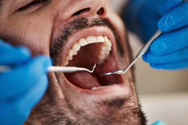 Best Emergency Dentist for Knocked-Out Tooth in Watertown, FL
